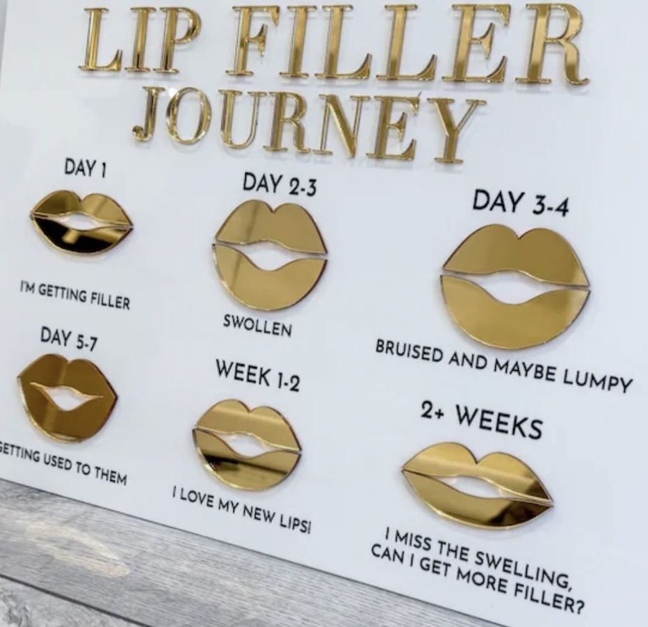 Lip filler healing journey from day 1 to 2+ weeks