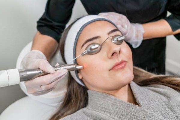 Beauty laser technician performing a cosmetic skin resurfacing session on a female patient, also called a laser peel  or photofacial, with an Er:Yag laser (infrared wavelength).